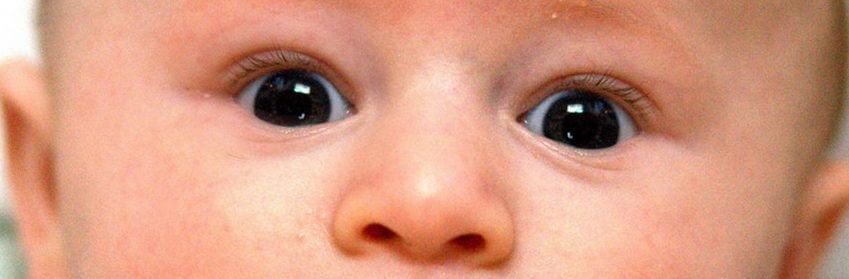 Infant's eyes